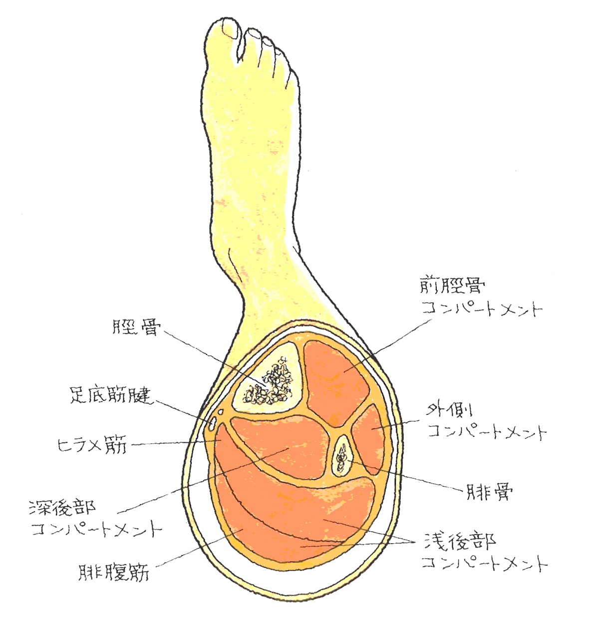 ３２ 腓腹筋断裂 ひふくきんだんれつ 肉離れ 交通事故後遺症の法律相談は被害者側専門弁護士 東京渋谷法律事務所